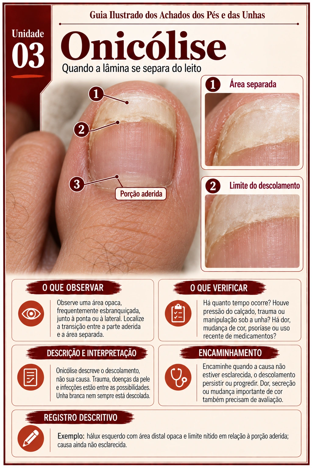 Prévia 3